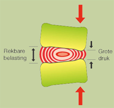 Ontstaan rugpijn zittende houding