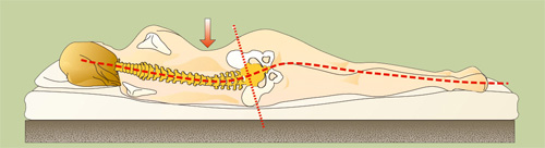 Slapen zonder rugpijn: zachte bodem