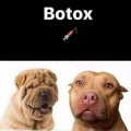 botox?